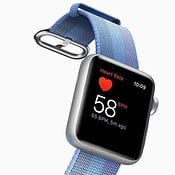 'Toekomstige Apple Watch-bandjes hebben functieknoppen en zijn aanraakgevoelig'