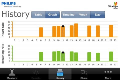 philips vital signs