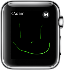 apple-watch-tekening