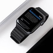 Apple Watch batterijconditie