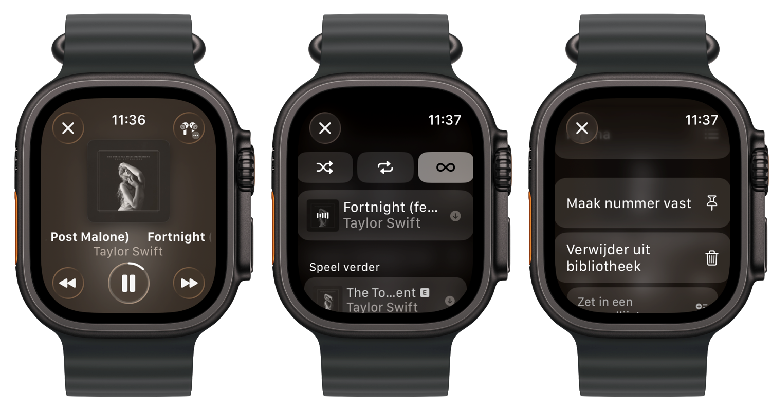 Opties Muziek Apple Watch