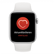 Meldingen voor onregelmatig hartritme op de Apple Watch: zo werken ze