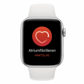 Meldingen voor onregelmatig hartritme op de Apple Watch: zo werken ze