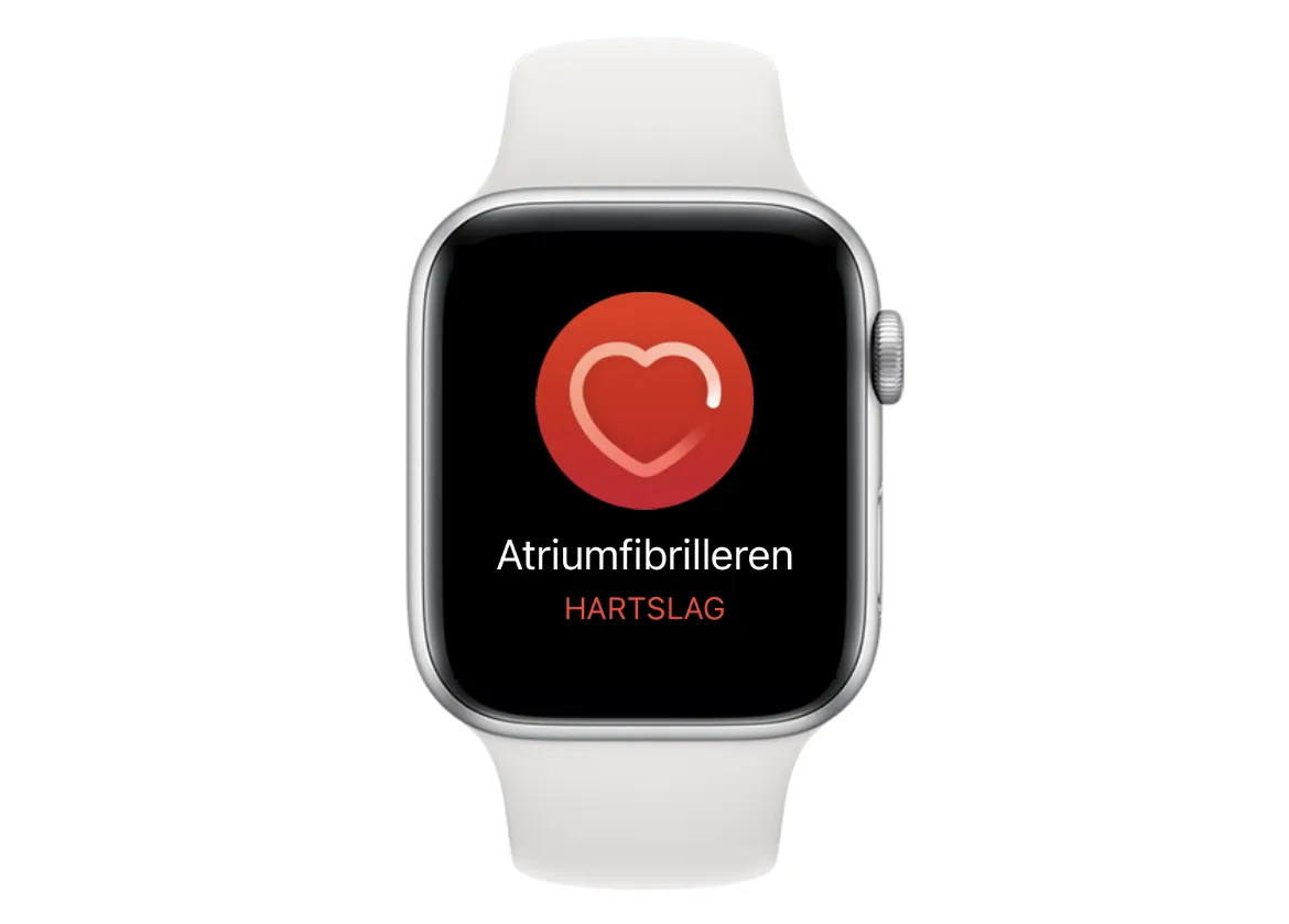 Meldingen voor onregelmatig hartritme op de Apple Watch: zo werken ze
